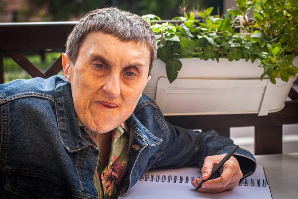 Disabled man with cerebral palsy writes in a notebook while sitting outdoors at Special Care Dentistry of Oregon in Albany, OR